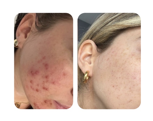 Antes y después The Powernap Serum