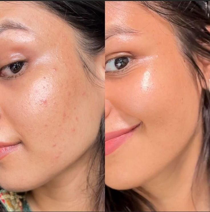 Antes y después The Bee Ready Cream